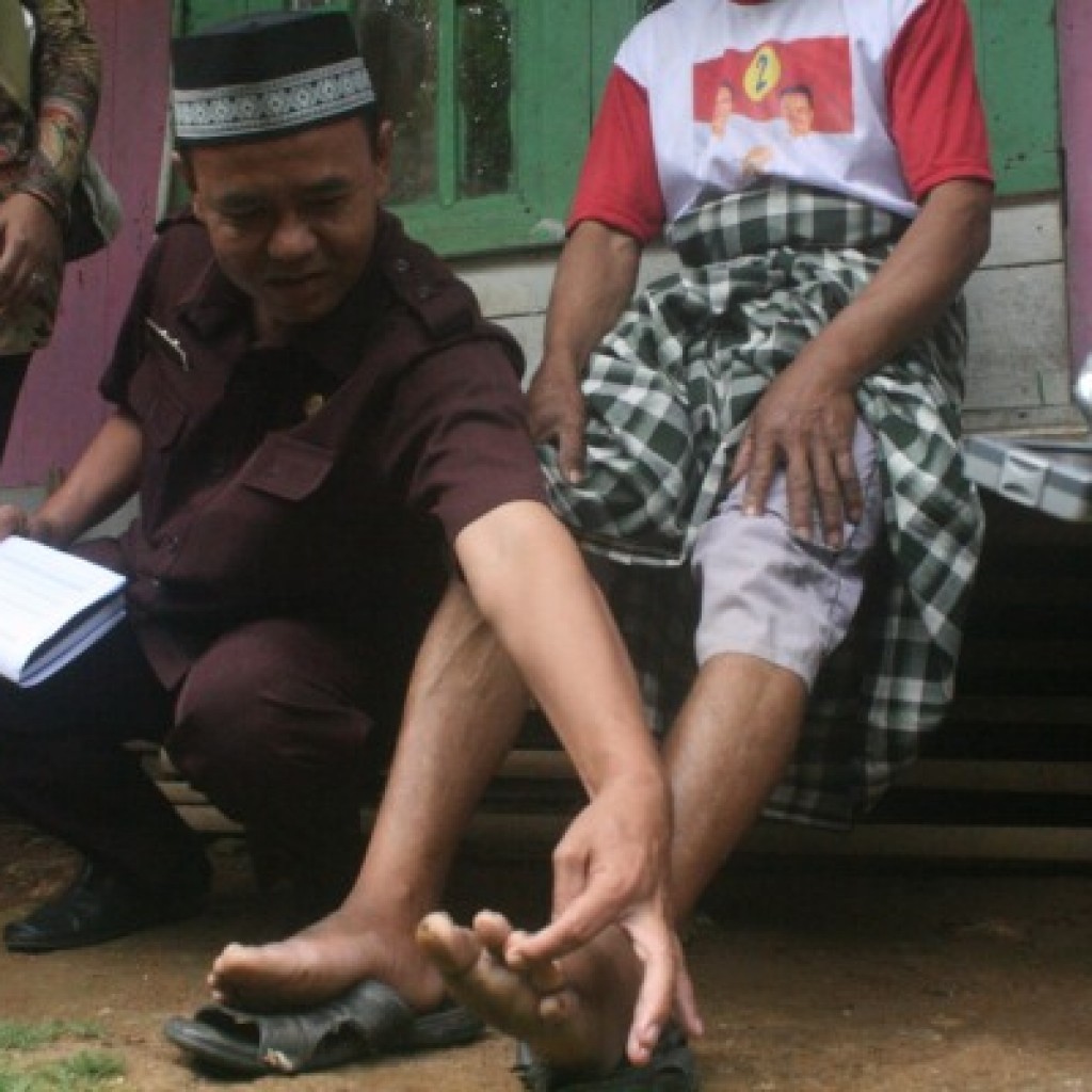 kaki gajah