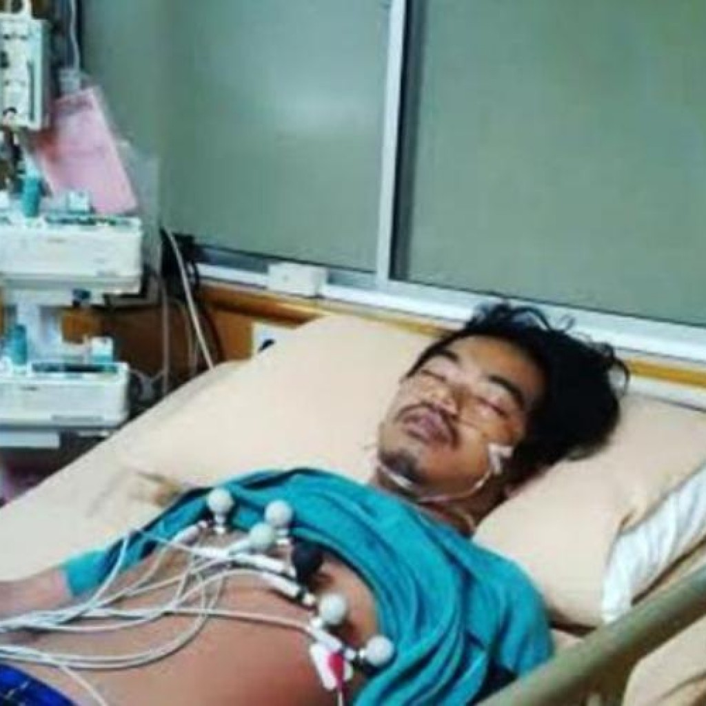 Dodit Mulyanto terkena serangan jantung