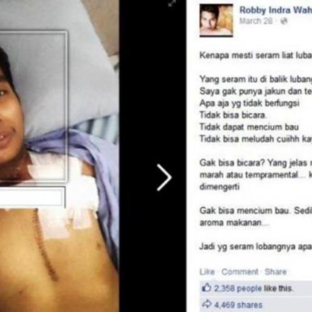 Robby Indra Wahyuda meninggal dunia