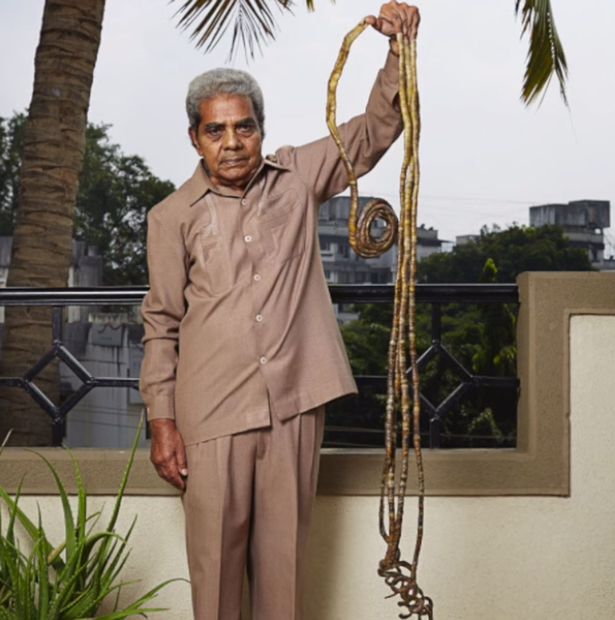 Nggak Potong Kuku Sejak Tahun 1952, Pria Ini Cetak Rekor Guinness Book of Records