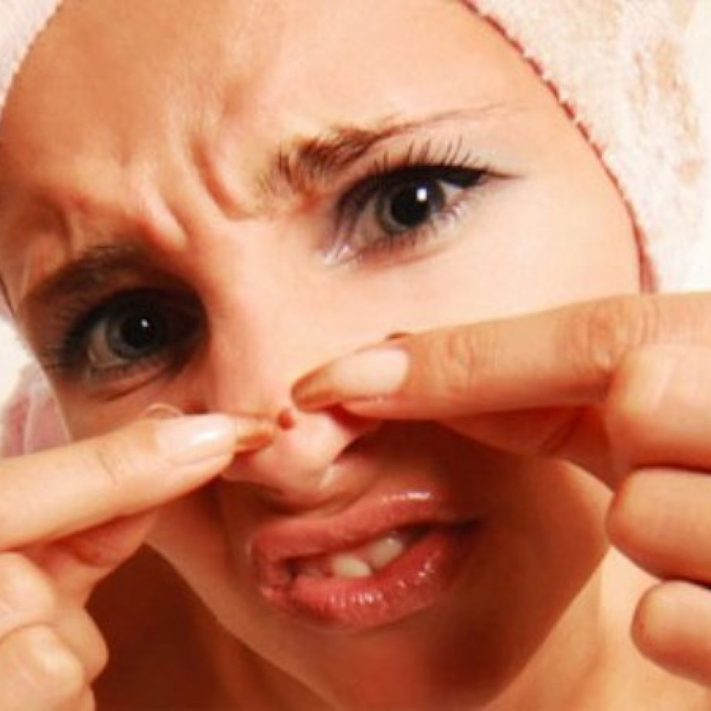 Tips Untuk Mengatasi Jerawat Pada Hidung