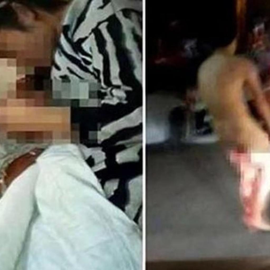 Ketahuan Selingkuh Istri Potong Kemaluan Suami