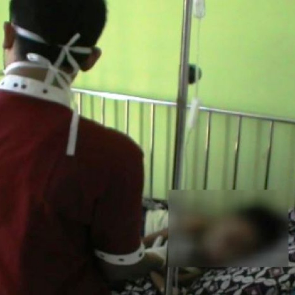 Bocah Penderita Kanker Mata di Tasikmalaya