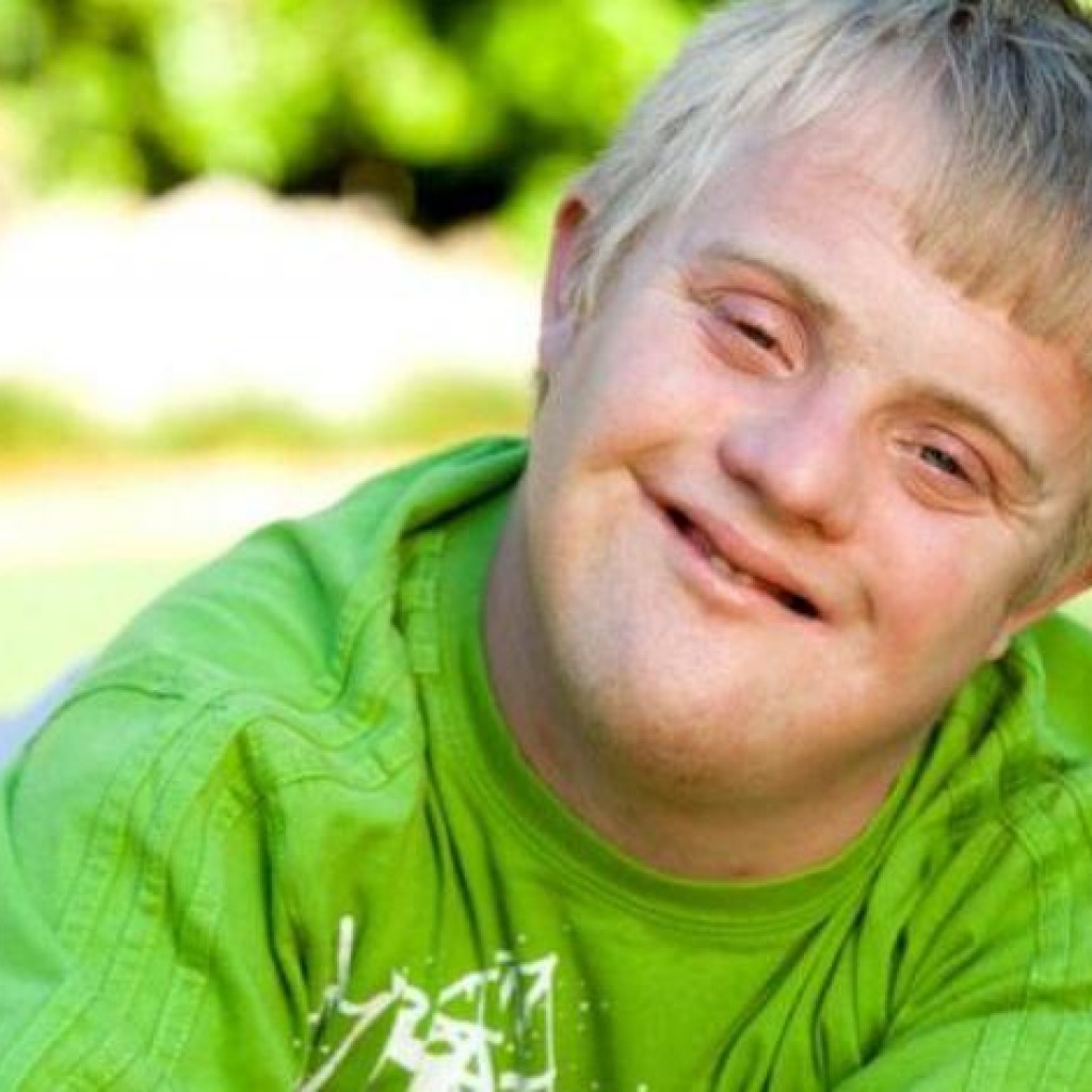 Symptoms Of Down Syndrome