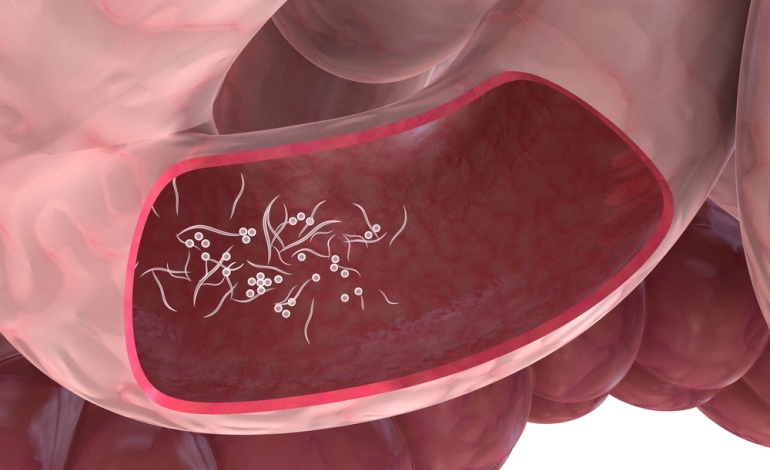 7 Signs That You Have Parasites In Your Body