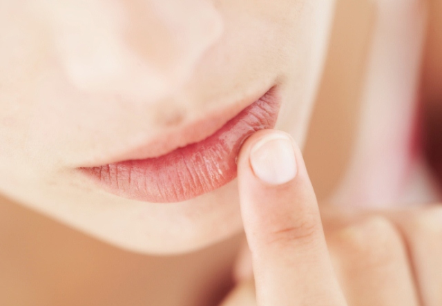 how to cope with dry lips when puasa