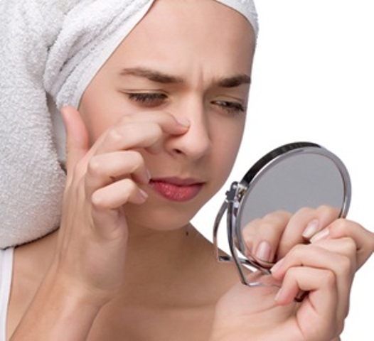 masker sederhana untuk mengatasi masalah komedo