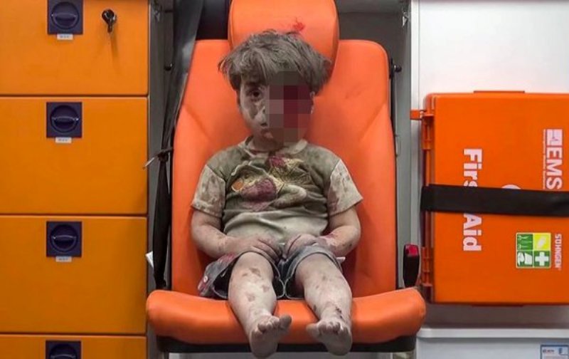 Omran Daqneesh