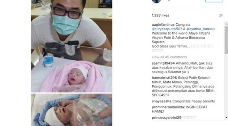 SELAMAT Cynthia Lamusu dan Surya Saputra Dikaruniai Bayi Kembar