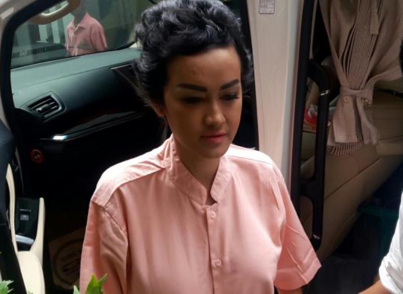 Jalani Operasi Syaraf Kondisi Julia Perez Makin Membaik