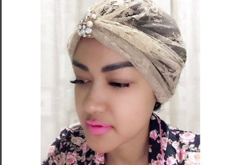 Pasca Drop dan Lakukan Transfusi Darah Ini Kondisi Julia Perez