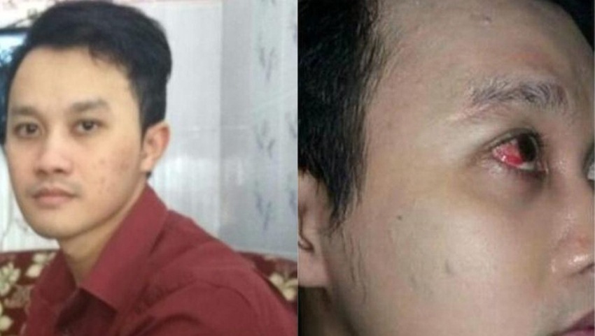 Cerita Jefri Ardiansyah Korban Pemukulan Driver Ojek Online yang Videonya Sempat Viral