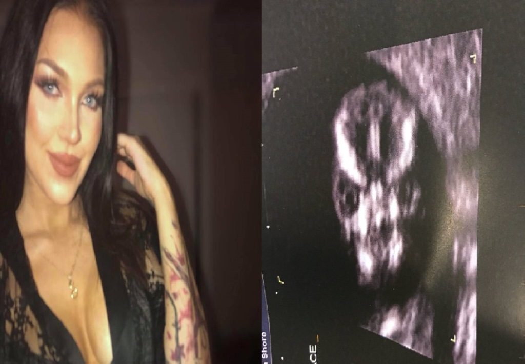 Foto USG Wanita ini Tiba Tiba Viral Wajah Aneh Calon Bayi Bikin Sang Ibu Kaget