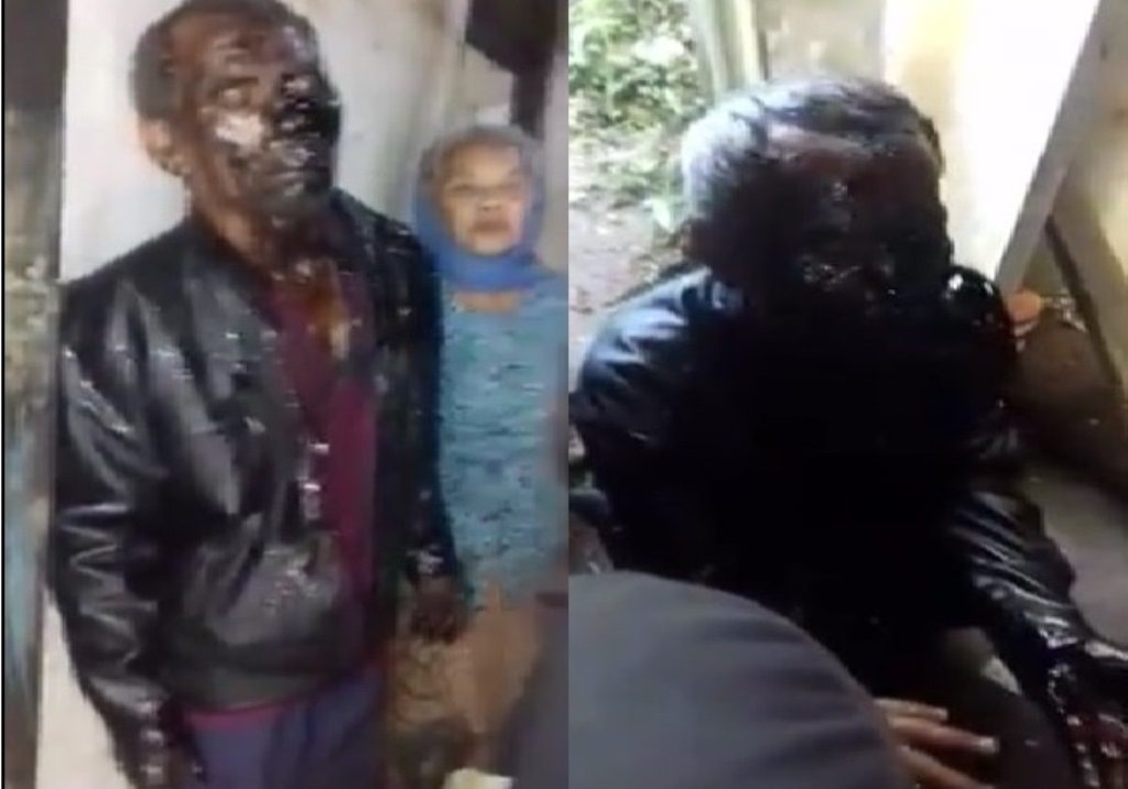 Cekcok dengan Lurah Gara Gara Hal Ini Seorang Warga Tersiram Aspal Panas