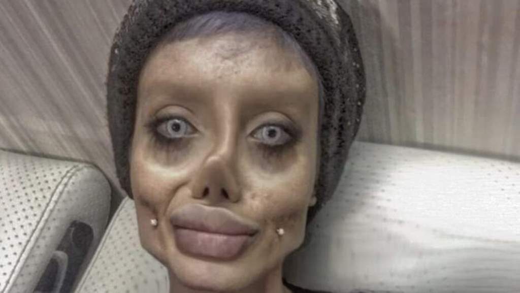 Sahar Tabar Wanita yang Terobsesi Mirip Angelina Jolie Ungkap Foto Dirinya Sebelum Operasi Wajahnya Bikin Syok