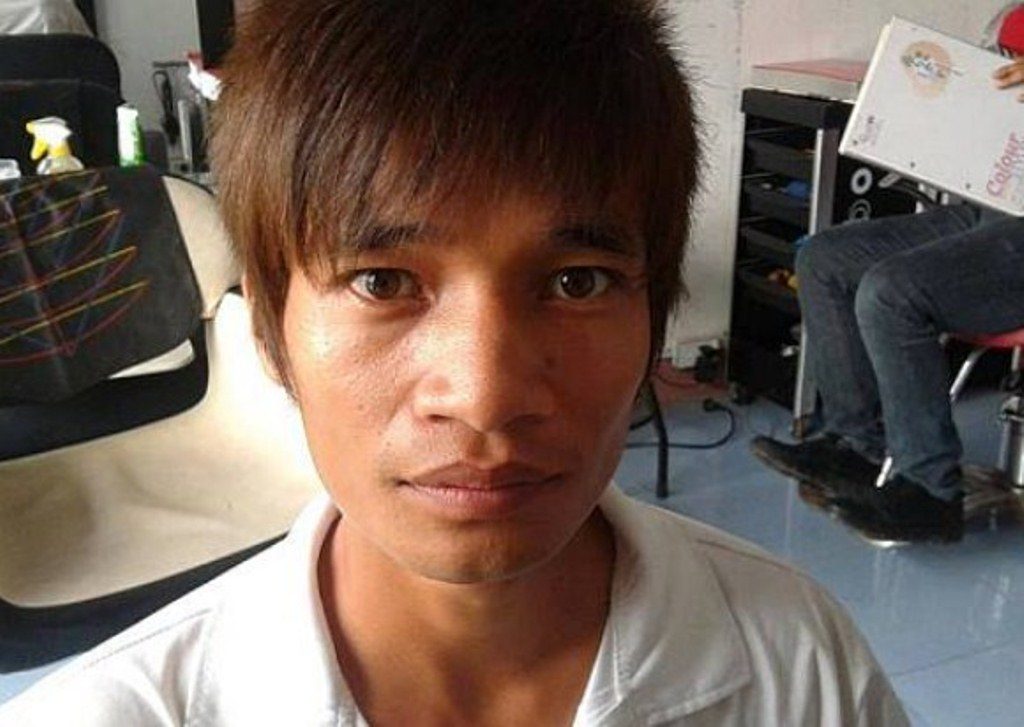 Kurang Percaya Diri Pria Ini kecanduan Operasi Plastik Sampai 30 Kali