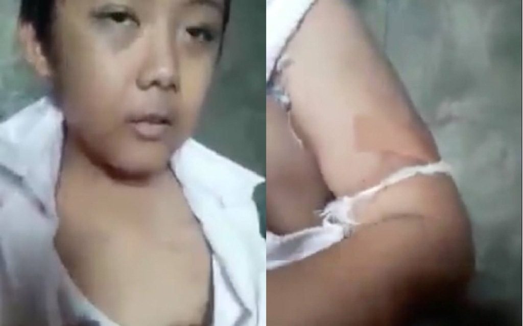 Viral Bocah Ini Disiksa Ibunya Sendiri Sampai Memar Dari Dipukul Hingga Disiram Air Panas