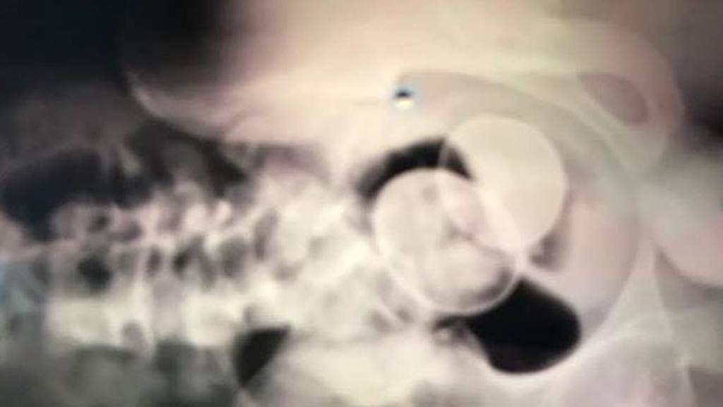 Dari Penglaris Hingga Perawatan Wajah Ulah Nyeleneh Warga Setelah Dapat telur Akmal Ini Bikin Geleng Geleng Kepala