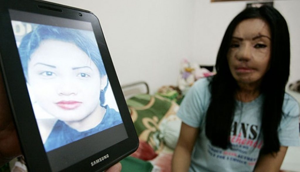 14 Tahun Kasus Berlalu Begini Kabar Lisa Face Off Korban KDRT dari Surabaya
