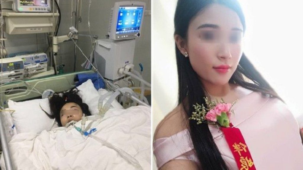 Jadi Bridesmaid di 2 Pernikahan Nasib Wanita ini Berakhir Malang Hampir Meninggal dan Kaki Diamputasi