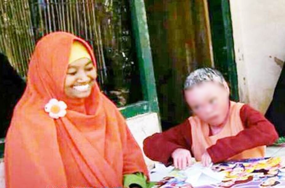 Mengeras bak Lilitan Plastik Anak di Ciamis Alami Kelainan Kulit Sejak Lahir