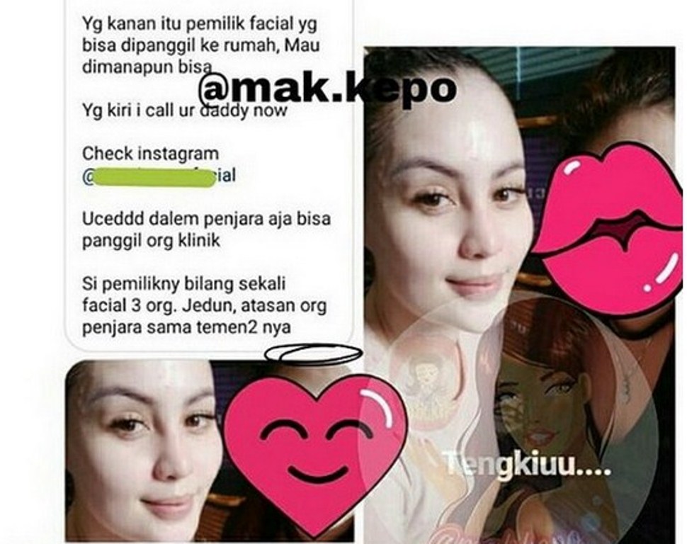 Netizen Heboh Beredar Foto Jennifer Dunn Perawatan Wajah di Tahanan