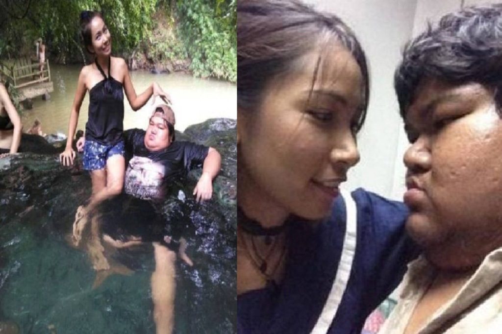 Pria Berbobot 120 Kg ini Sering Dibully Karena Pacari Cewek Cantik Setelah 10 Tahun Kini Hal yang Tak Disangka Terjadi