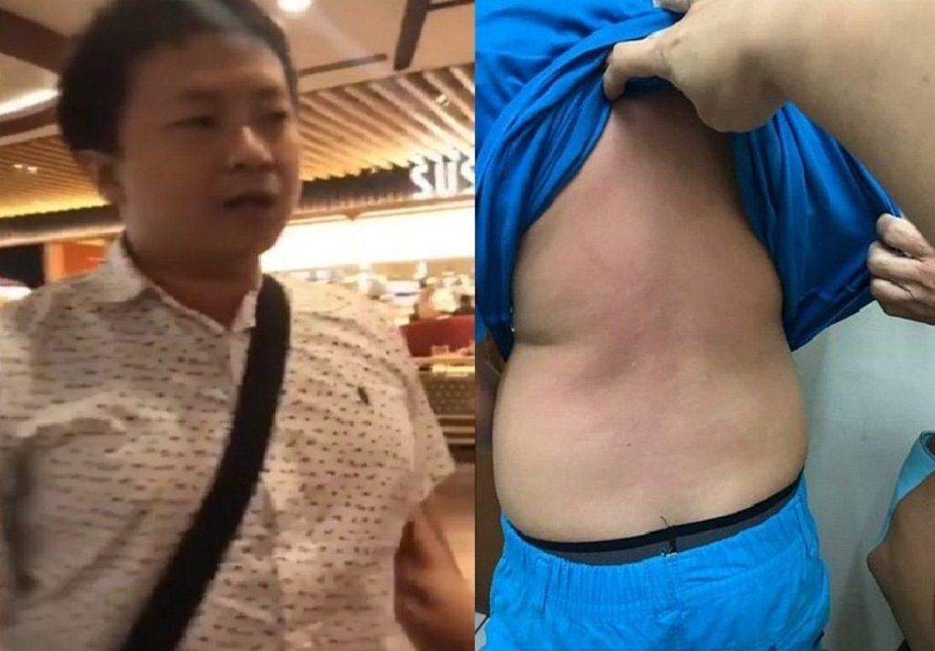 Putrinya Tak Sengaja Tersenggol Ayunan Di Playground Pria Ini Tendang Punggung Anak Di Bawah Umur