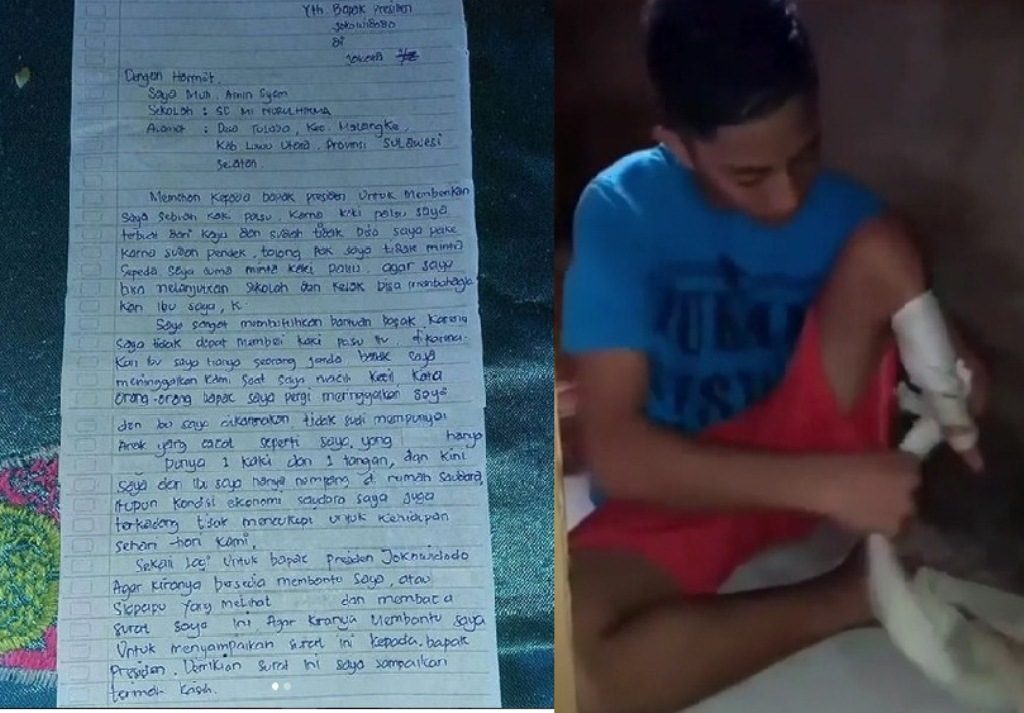 Tidak Perlu Sepeda Anak ini Minta Kaki Palsu ke Presiden Jokowi Isi Suratnya Menyentuh Hati