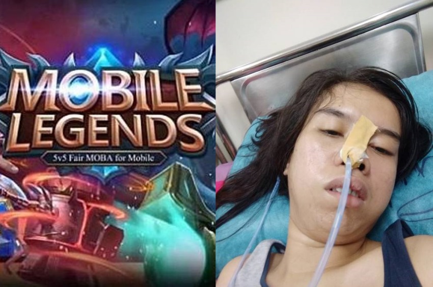 Kecanduan Mobile Legends Wanita ini Alami Hal Tak Terduga Sampai Dirawat di Rumah Sakit