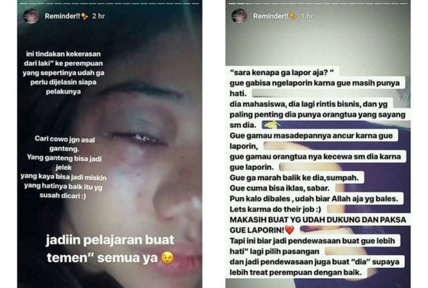 Gak Mau Lapor Polisi Meski Sudah Dianiaya Hingga Nyaris Meninggal Alasan Cewek ini Bikin Greget Sekaligus Haru