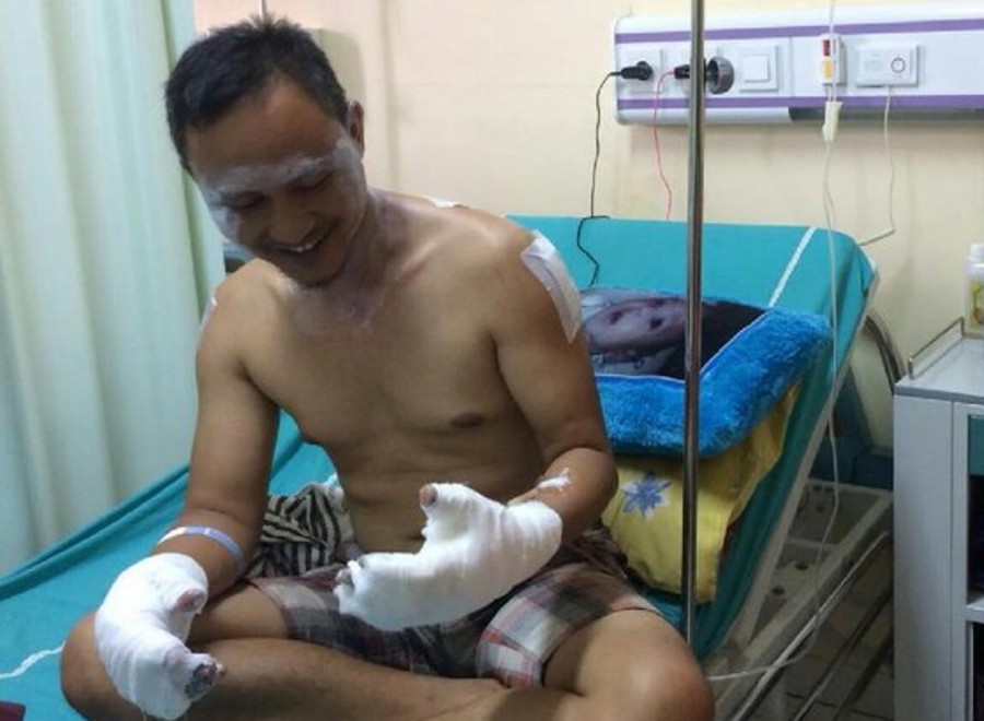 Ledakan Pabrik Kayu di Ciamis 8 Orang Terluka