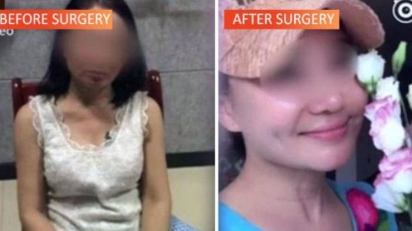 Wanita ini Nekat Lakukan Operasi Plastik hingga Terlihat Seperti Gadis 20 Tahun Alasannya karena Hutang