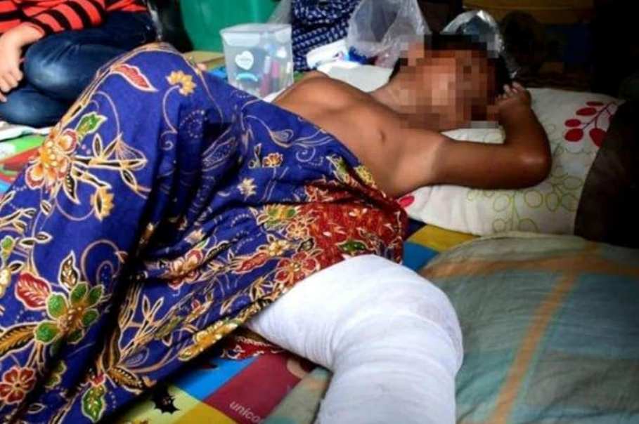 Jadi Korban Persekusi Teman Bocah di Tanjungbalai Disuruh Minum Air Kencing dan Dibakar