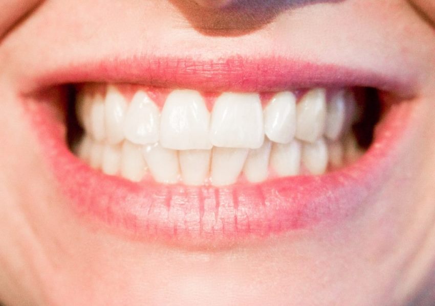 Mencengangkan 10 Tahun Tak Sikat Gigi Wanita ini Mengaku Giginya Tetap Sehat