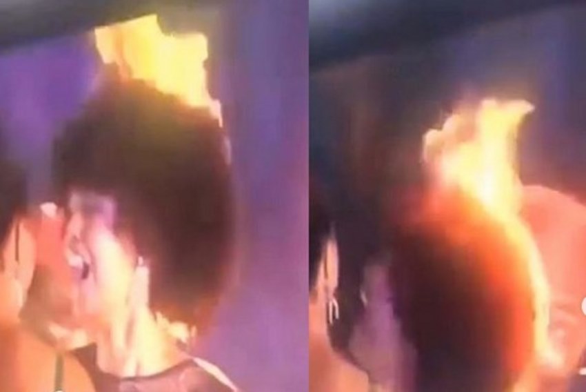 Rambut Miss Congo Terbakar Usai Dinobatkan sebagai Wanita Tercantik di Afrika, Videonya Viral Rambut Miss Congo Terbakar Usai Dinobatkan sebagai Wanita Tercantik di Afrika Videonya Viral