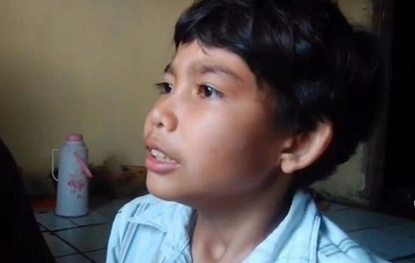 Tak Sengaja Telan Peluit Bocah Kelas 5 SD di Bandung Keluhkan Sesak Nafas Jika Jalan Jauh
