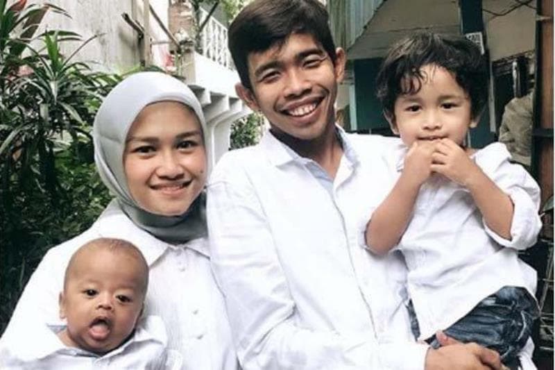 Idap Williams Syndrome Putra Kedua Dede Sunandar Harus Jalani Operasi Jantung