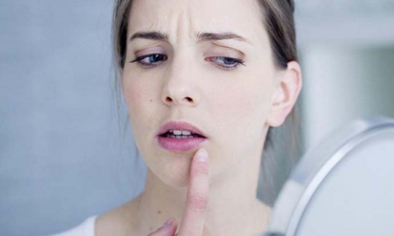 8 Cara Mencegah Bibir Kering Saat Puasa