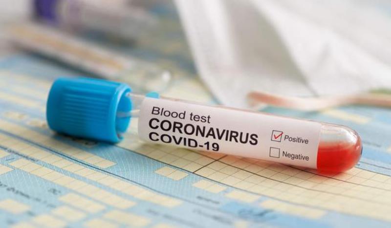 Pasien Pertama Positif Terinfeksi Virus Corona di Ciamis Berhasil Sembuh