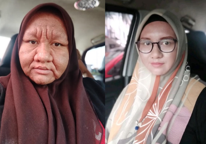 VIRAL Wajah Wanita ini Berubah Jadi Tua dan Keriput Saat Hamil Ini Reaksi Sang Suami