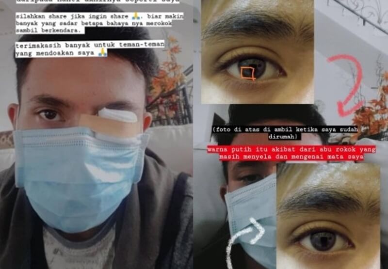 Curhat Pemotor Matanya Iritasi Akibat Kena Abu Rokok dari Pengendara Lain