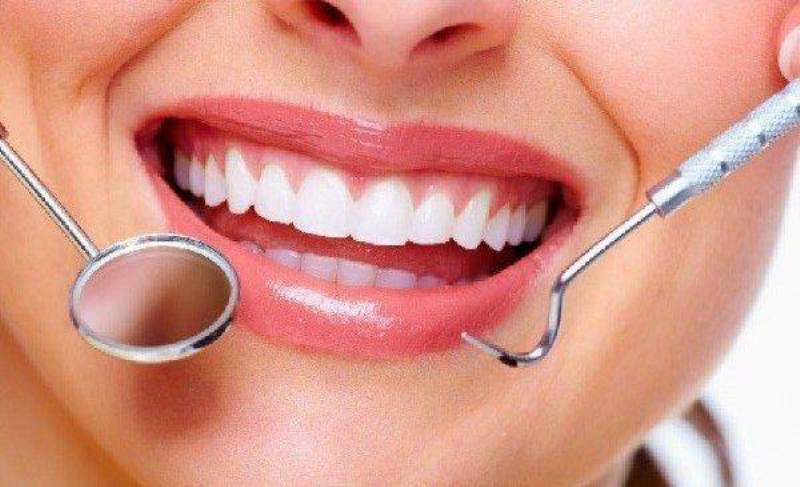 Gak Perlu Ribet 6 Cara Menghilangkan Karang Gigi Secara Alami ini Bisa Dicoba