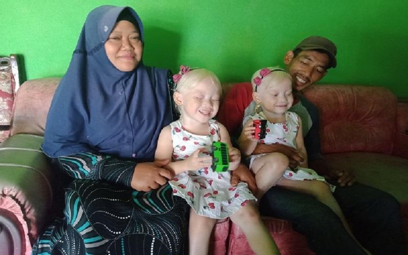 VIRAL Bocah Perempuan Kembar Albino di Wonogiri, Sering Dikira Bule VIRAL Bocah Perempuan Kembar Albino di Wonogiri Sering Dikira Bule