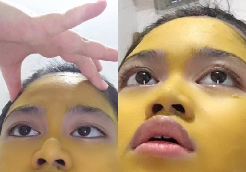 Pakai Masker Kunyit untuk Perawatan Kecantikan Wajah Gadis ini Malah Jadi Kuning