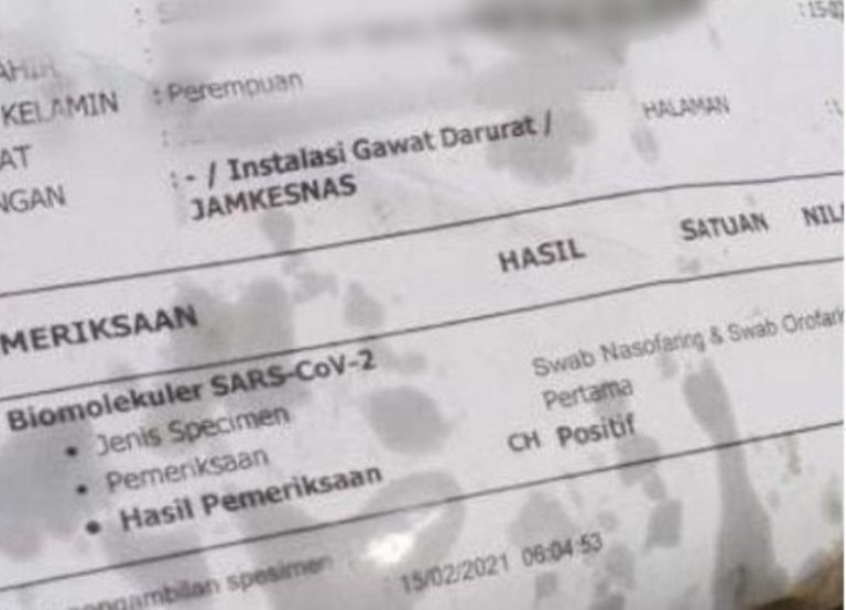 Kertas Bekas Hasil Swab Positif Covid 19 Jadi Pembungkus Gorengan Pembeli Auto Panik