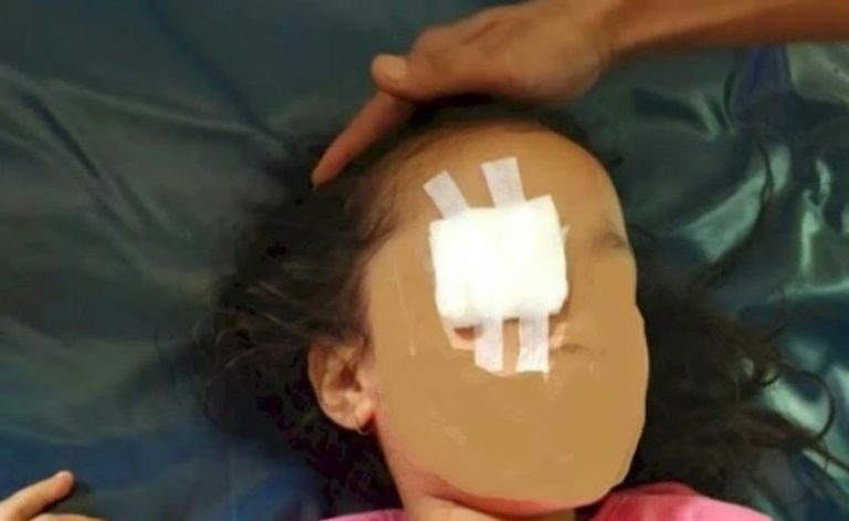 Aksi Sadis Orangtua di Sulsel yang Cungkil Mata Anak Perempuannya Diduga Demi Pesugihan