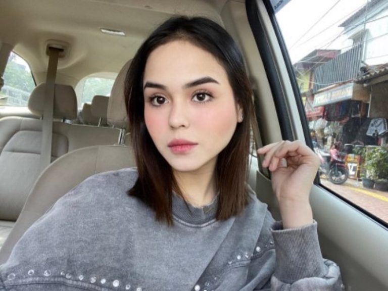 Selebgram Edelenyi Laura Anna Meninggal Netter Syok