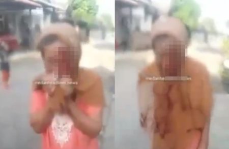 Hanya Karena Tak Diberi uang Anak ini Tega Lempar HP ke Wajah Ibu Hingga Berdarah