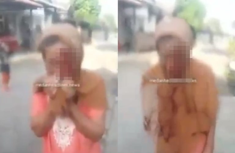 Hanya Karena Tak Diberi uang Anak ini Tega Lempar HP ke Wajah Ibu Hingga Berdarah